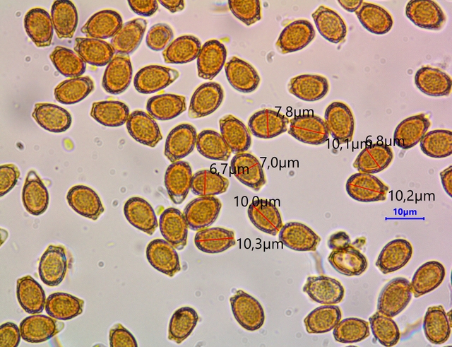 Ganoderma aspersum x 1000.jpg