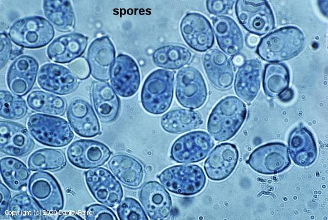 Dendrothele alliacea (Dendrothele_alliacea_2020_df_3.jpg)