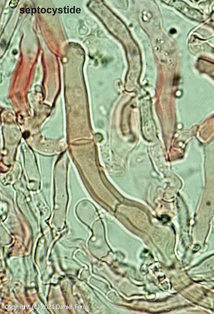 Hyphodontia alutaria (Hyphodontia_alutaria_2021_df_5.jpg)