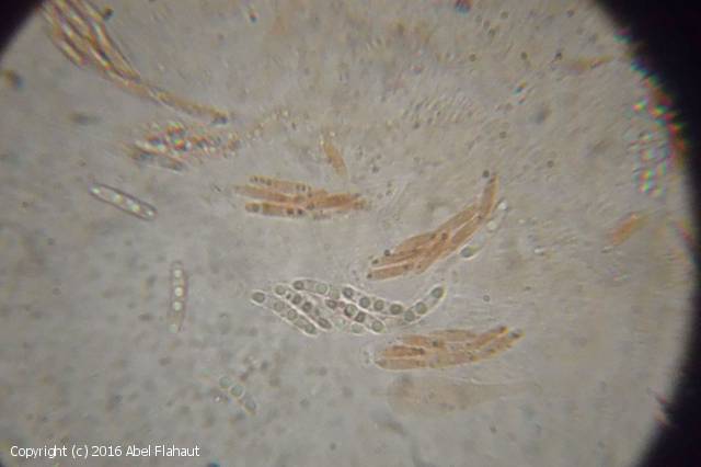 Nitschkia cupularis (Nitschkia_cupularis_2016_af_3.jpg)