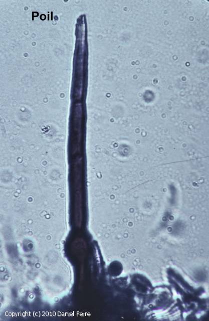 Pyrenophora trichostoma (Pyrenophora_trichostoma_2010_df_2.jpg)