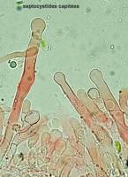 Fiche de Hyphodontia alutaria