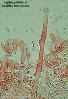 Fiche de Hyphodontia alutaria