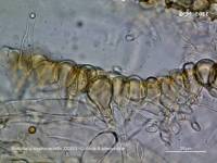 Fiche de Strobilurus stephanocystis